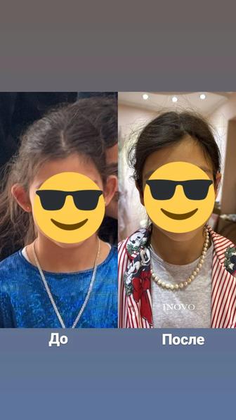 Отопластика ушей без шрамов