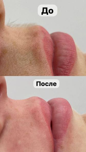 Шугаринг БЕСПЛАТНО
