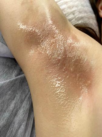 Мастер по шугарингу.