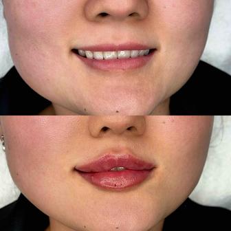 Ищу моделей на увеличение губ для портфолио