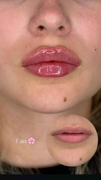 Ищу моделей на увеличение губ для портфолио