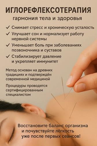 Иглотерапия