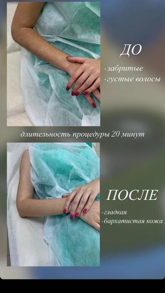 Шугаринг по вкусным ценам