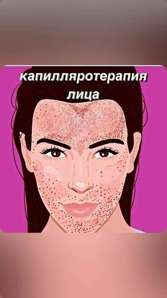 капилляротерапия лица