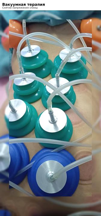 Вакуумные банки снятие напряжения и зажимов в теле