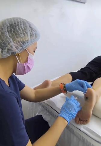 Лечение пяточной шпоры