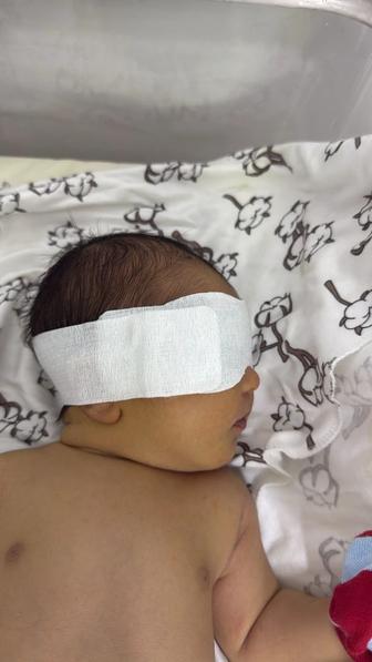 Маска для новорожденных для фототерапии. Очки для фототерапии