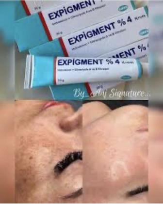 Отбеливающий крем Expigment 4% (30г)
