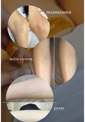 Шугаринг на всё зона