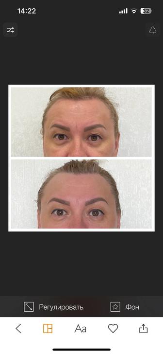 Скульптурный массаж лица