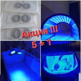 Лампа от желтушки