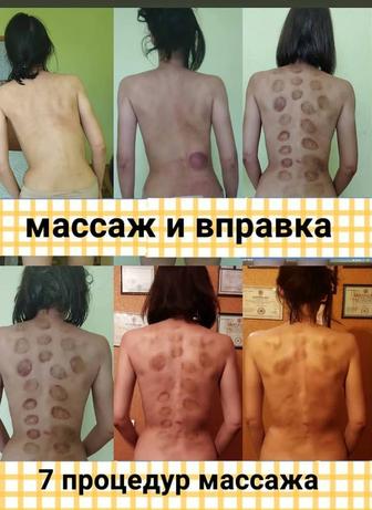 Обучение массажу