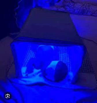 Кувез фото лампа от желтушки Аренда