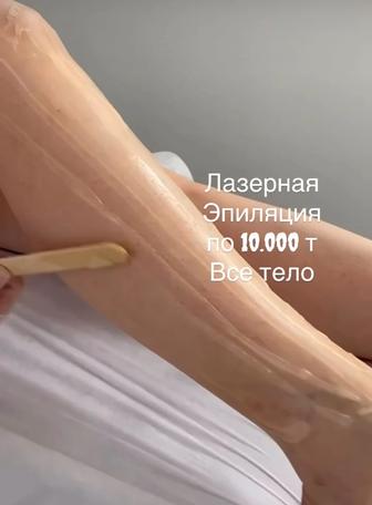 Лазерная эпиляция на выезд