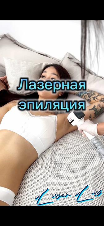 Лазерная эпиляция