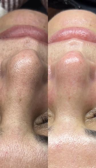 Комбинированна чистка