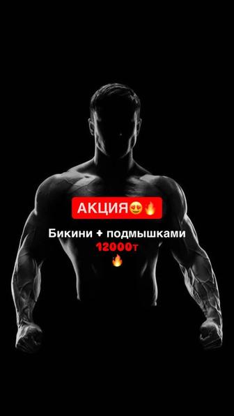 Шугаринг
