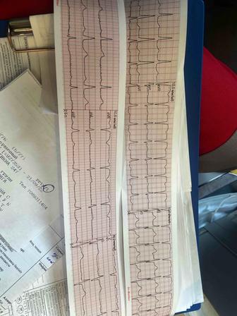 Экг курс за 2 часа, основы ЭКГ простыми словами