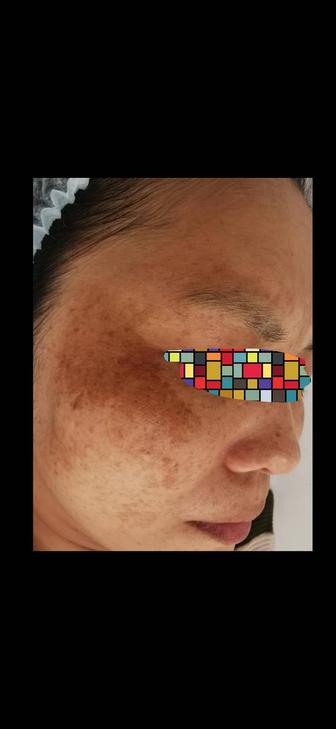 Косметология Астана