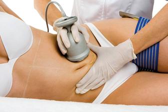 Массаж Антицеллюлитный живота