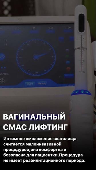 СМАС-Лифтинг интимное омоложение для женщин