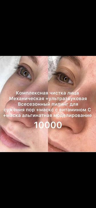 Услуги Косметолога