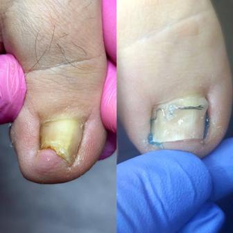 Педикюр и маникюр