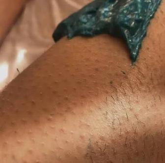 Шугаринг, восковая эпиляция