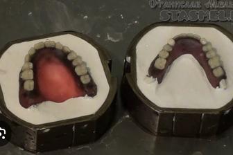 Зубопротезирование