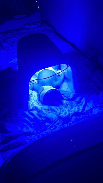 Фотолампа от желтушки