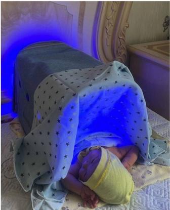 Лампа от желтухи