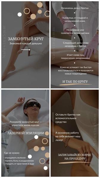 Лазерная эпиляция