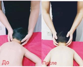 Массаж детский ЛФК