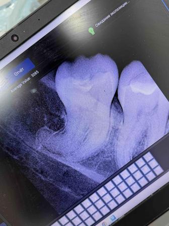 Продам рентген визиограф