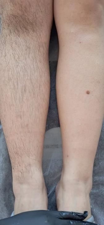 Шугаринг. Все гладко и сладко