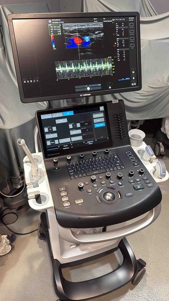 Продам узи аппарат GE Versana Premier