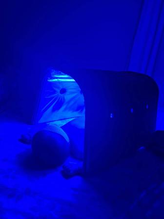 Фотолампа лечение желтухи