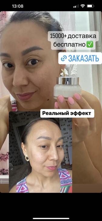 Крем от пигментации для лица