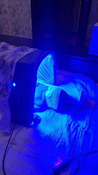 Лампа от желтушки