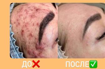 Чистка лица, массаж для лица.