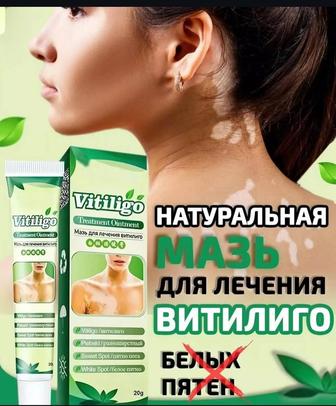 Мазь от витилиго