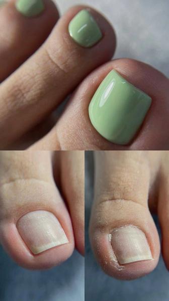 Педикюр, смарт ,классический,обработка мозолей ,натоптышей.