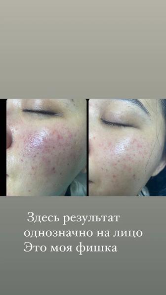 Услуги эстет-косметолога.