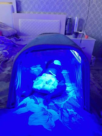 Лампа кювез от желтушки