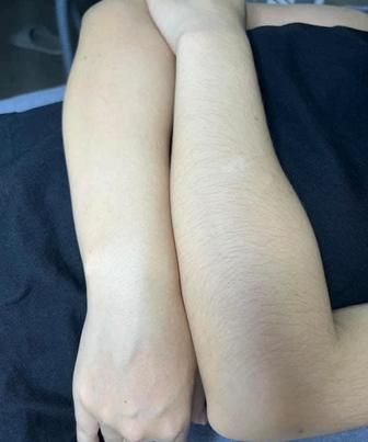 Шугаринг полное