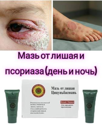 Мазь день и ночь от лишая и псориаза