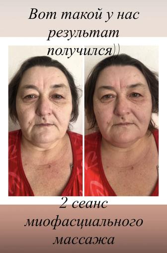 Мышечной- миофасциальный массаж