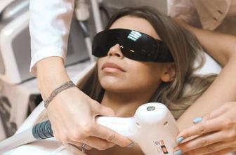 Лазерная эпиляция