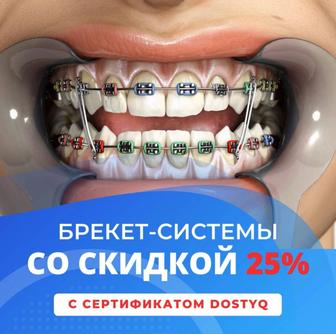 Брекет-системы со скидкой 25%