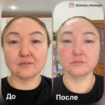 Обучение массажу по лицу и телу